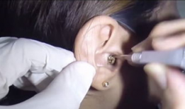 挖耳屎视频,趣味视频带你探索耳道清洁的奥秘